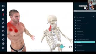 (Myofascial) Trigger Points and Osteopathy a Match Made in Heaven -Webinar Excerpt- screenshot 5