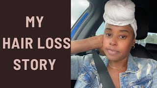 My hair fell out| My hair loss story