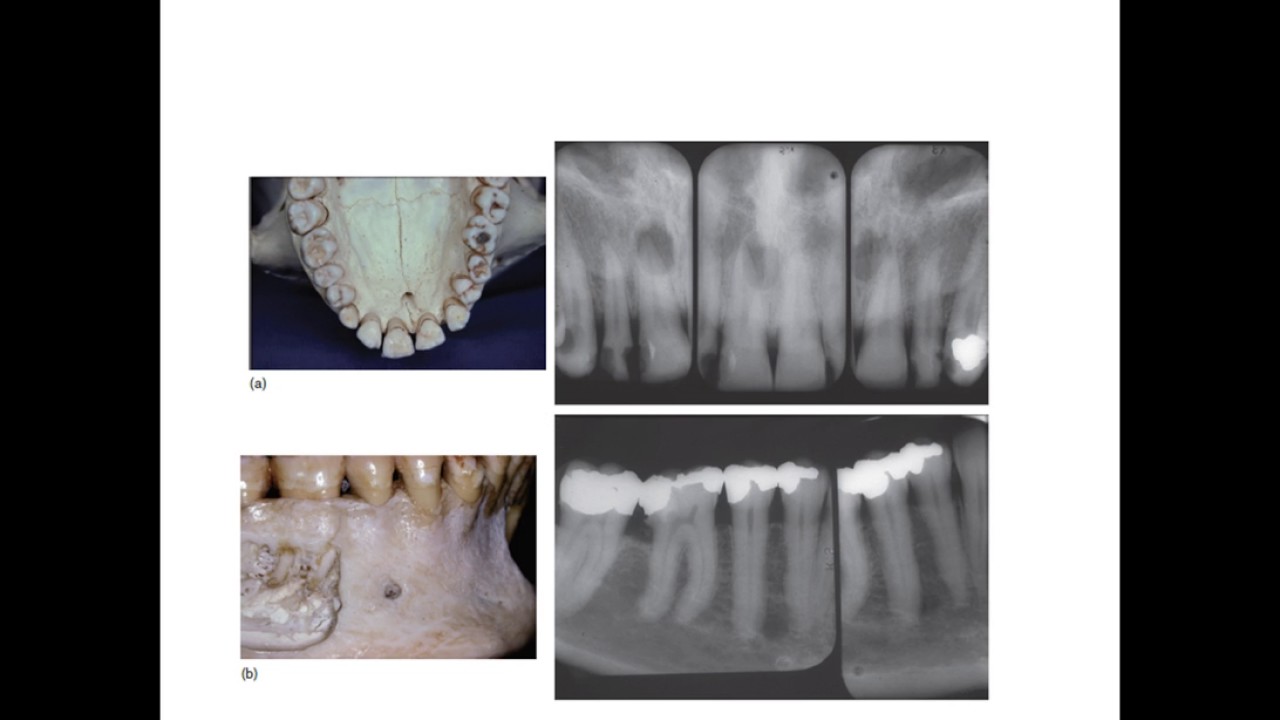 Dr . Mazen Doumani Basic Endodontics For Undergraduate students II