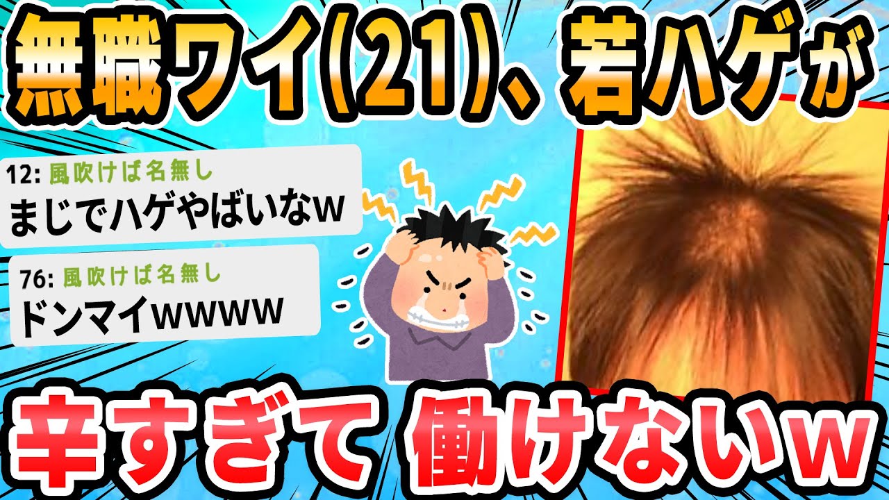 【2ch面白いスレ】若ハゲ辛い氏にたい働けない辛すぎる