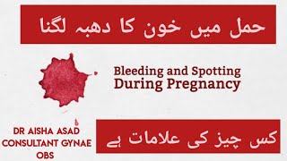 Spotting / Bleeding in Early pregnancy| Hamal me Khoon ka dhabba lgna- Urdu/ Hindi