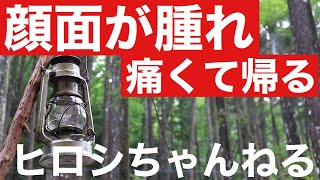 抜いた親知らず痕が痛くて途中で帰るキャンプ