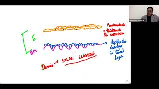 Pre Cancerous Skin Lesion Actinic Keratosis Skin Pathology Dr Kishore Banerjee Gmt20220403 1747