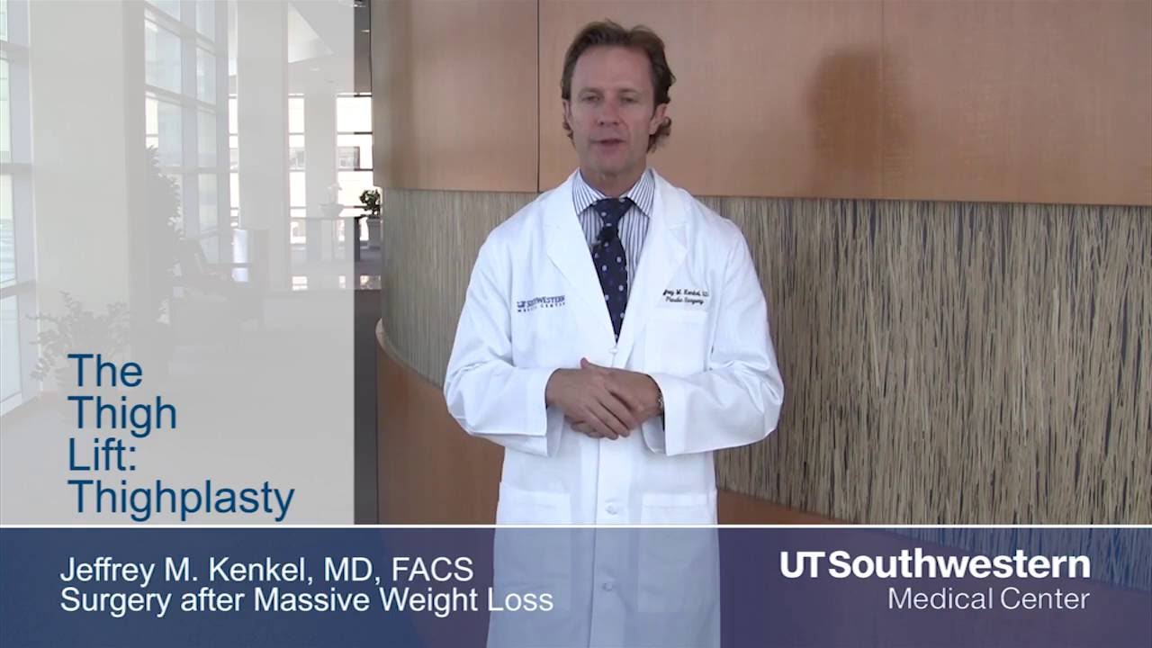 Thighplasty What to Expect After Massive Weight Loss YouTube