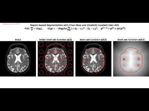 Region-based Segmentation | Chan-Vese | Snakes | Level Sets | Gradient Descent | python