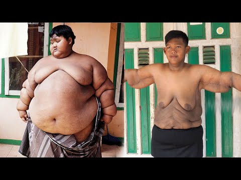 \"დედა მაჭამე,დედა მშია\".. რა დაემართა 10 წლის ბიჭს რომელიც 192 კგ-ს იწონიდა?