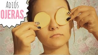 Para herencia de caseros las ojeras remedios