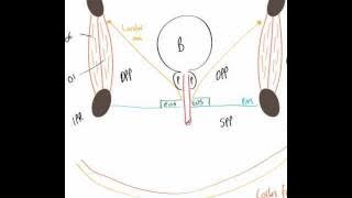 Perineal Pouches Part 2