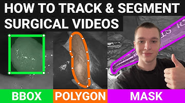 How to annotate surgical videos fast using neural networks