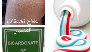 علاج تشققات القدم العلاجات المنزلية