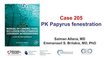Case 205: Manual of CTO PCI - PK Papyrus fenestration