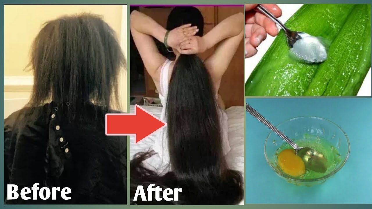 How To Grow Long Thicken Hair with Aloe Vera Gel And Agg/ Homemade