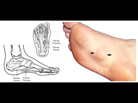 What Your Feet