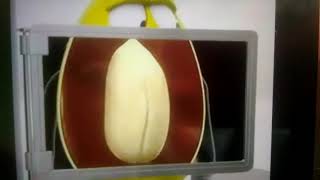 M&Ms X-Ray 2007 Polish