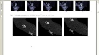 Famous IEEE 2014 IMAGE PROCESSING A CLASS OF CLOUD DETECTION ALOGORITHMS BASED ON A MAP MRF Net Worth