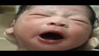 Rhys Brought Into This World 11232003 Dr. Erfan & Bagedo General Hospital Jeddah, K Saudi Arabia