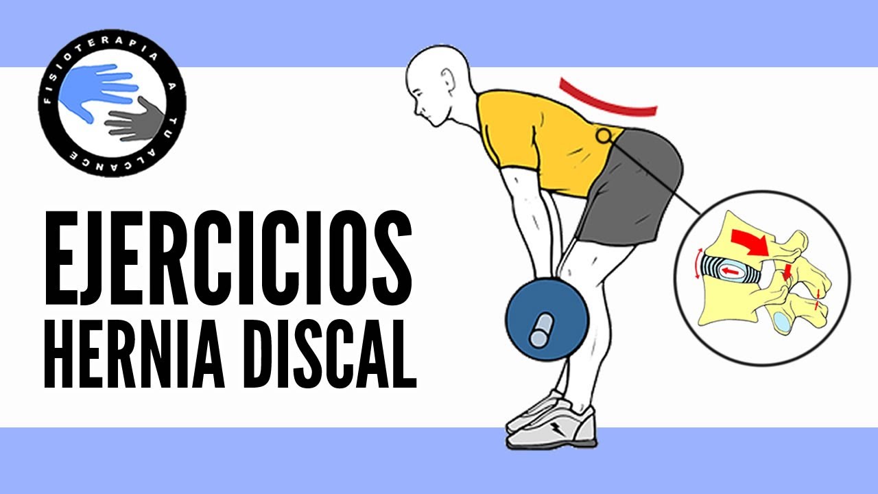 Se puede correr con hernia discal