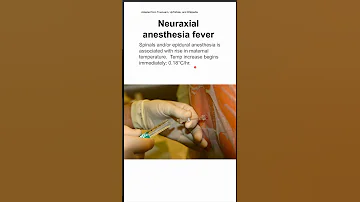 Neuraxial Anesthesia Fever 