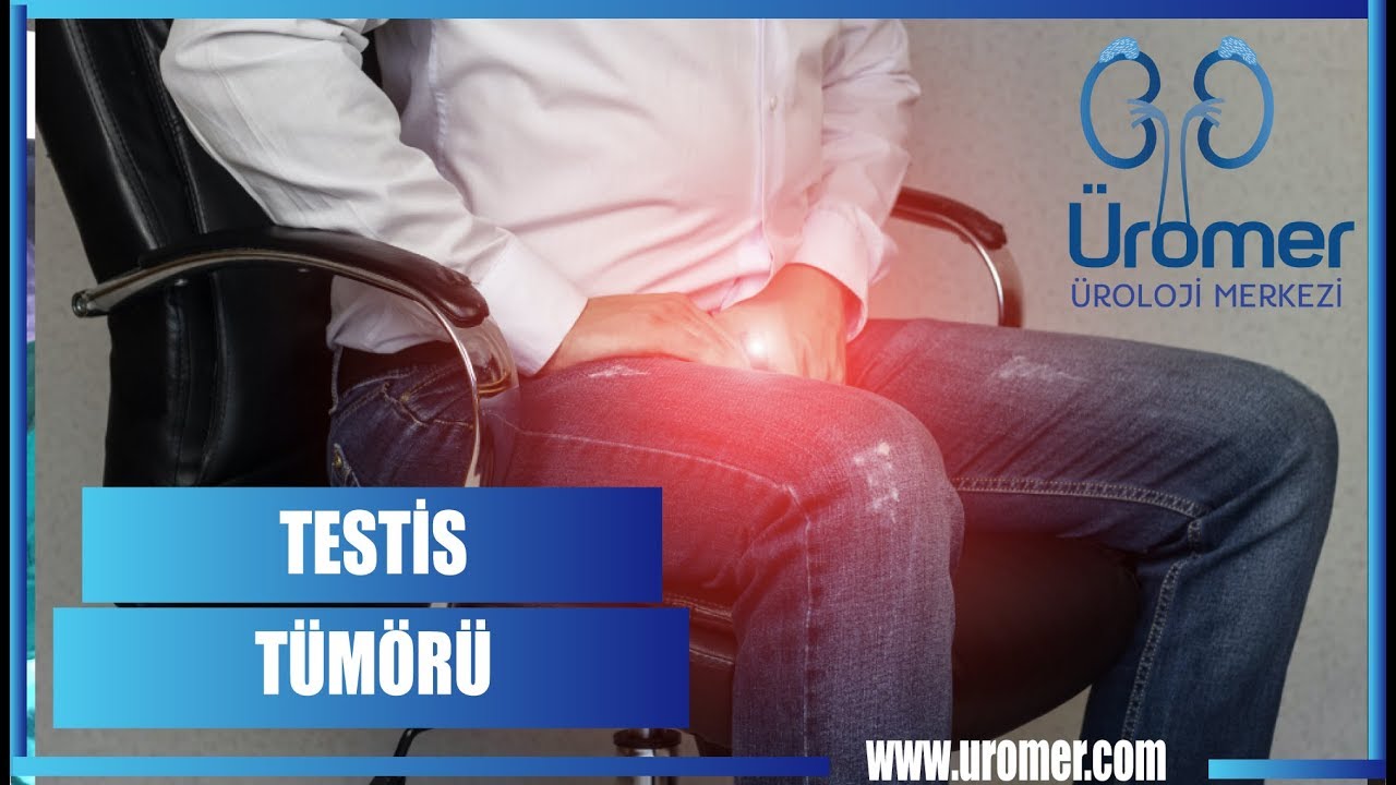 TESTİS TÜMÖRÜ | TESTİS KANSERİ NASIL OLUŞUR ? | Prof. Dr. Abdullah Armağan