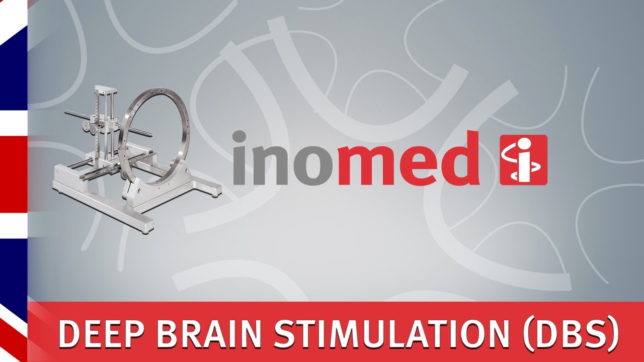 Deep Brain Stimulation - DBS - ISIS MER - stereotactic surgery - inomed ...