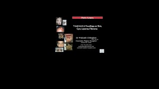 Stop ignoring the swellings on your body.Treatment of Skin swellings,Cyst,Lipoma by Plastic Surgery.