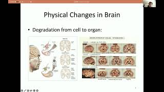 Tensor based Multi Modality Feature Selection and Regression for Alzheimer’s Disease Diagnosis