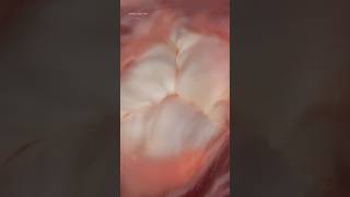 The Power and Precision of the Human Heart 🫀