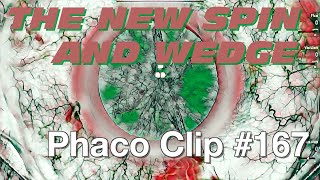 Phaco Clip #167 - Soft Lamellar WEDGE screenshot 1