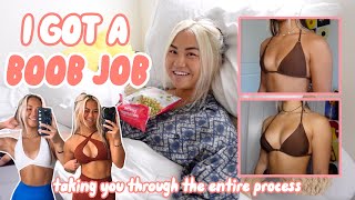 I GOT A BOOB JOB | my experience, recovery vlog, before & after pics