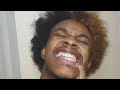 Post Malone Over Now Song Cover @postmalone