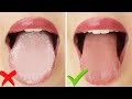 HOW TO: Get Rid of White Tongue & Bad Breath INSTANTLY!