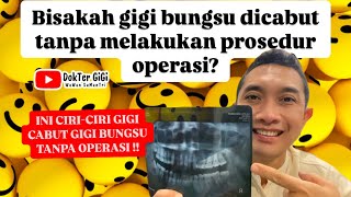 CIRI GIGI BUNGSU YG BISA DICABUT TANPA OPERASI KALIAN HRS TAHU‼️ #cabutgigibungsu #operasigigibungsu