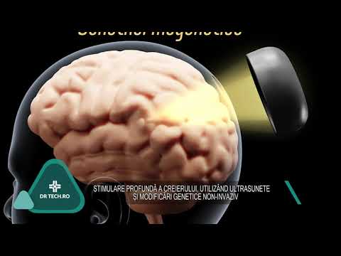Stimularea profundă a creierului, utilizând ultrasunete și modificări genetice - DrTech.ro