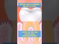 Root canal animation #rct #rootcanaltreatment #shortvideo #shortvideo