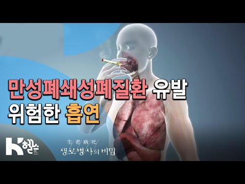 🚬흡연이 COPD를 유발하는 기전⚠ - 717회(19.12.04) 몰라서 더 무섭다, COPD(만성폐쇄성폐질환)