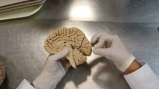 Neuroanatomía: corteza cerebral