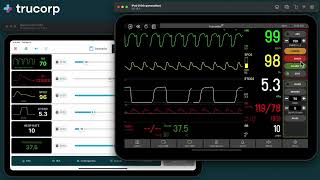 TruMonitor Quick Start 3 - Defib & CPR