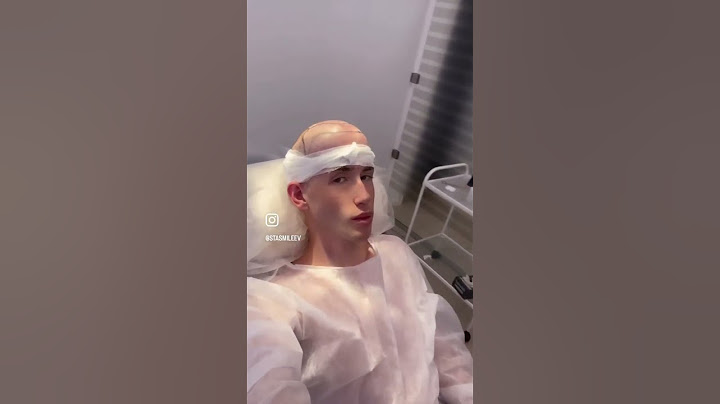 Я сделал ПЕРЕСАДКУ ВОЛОС 🥵 Полное видео с операции на канале!