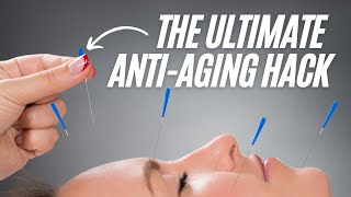 My Favorite Anti-Aging Hack: Facial Acupuncture