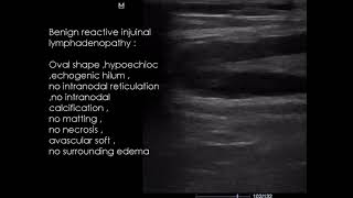 CASE 990 Benign reactive inguinal lymphadenopathy