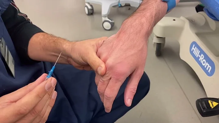 5 Reasons You're Bad At IVs (And How To Fix It!) 👊