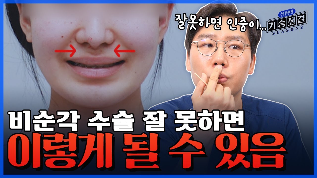 [Виверс гоо сайхны мэс заслын эмнэлэг] Хамар унжсан гэж хамаагүй хамар-уруулны өнцгийн мэс засал хийлгэвэл харин ч эмээ шиг болчихно...