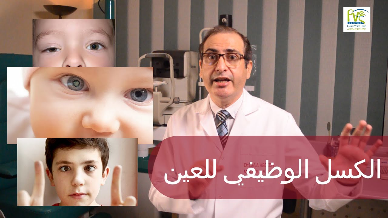 الكسل الوظيفي للعين ، أسبابه ، الوقايه منه وعلاجه