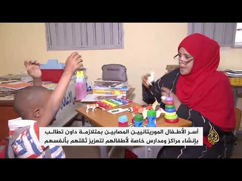 موريتانيون يتكتمون على إصابة أبنائهم بمتلازمة داون
