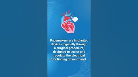 Pacemakers: Your Heart's Silent Hero || Dr. P Vijay Shekar