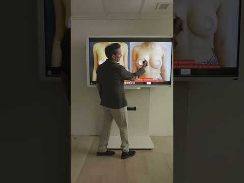 Pacientes asimetrías mamarias