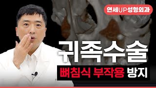귀족수술 부작용, 보형물로 인한 뼈침식 방지할 수 있을까?
