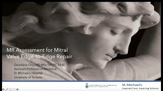 Echocardiographic Evaluation for Mitral Edge-to-Edge Repair