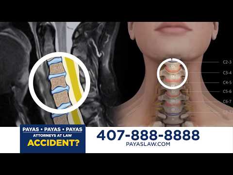 Auto Accident Attorneys