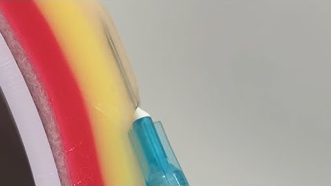 Where to Inject?